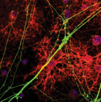 Image: This study showed that the drug benztropine led to the repair of multiple sclerosis-damaged nerve fibers in animal models (Photo courtesy of Dr. Luke Lairson, The Scripps Research Institute).